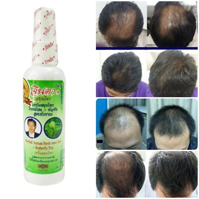 #ad Herbal Serum Growth Grow Hair Natural Serum Jinda Mee Leaf Ancient Formula 120ml