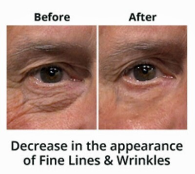 #ad Best 100% Under Eye Cream Remove Dark Circles Wrinkles Face Lines Puffy Eyes