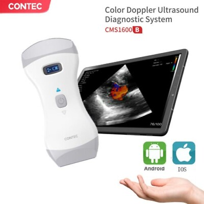 #ad Portable Wireless Ultrasound Scanner Probe Wifi Color Doppler 3 year Warranty